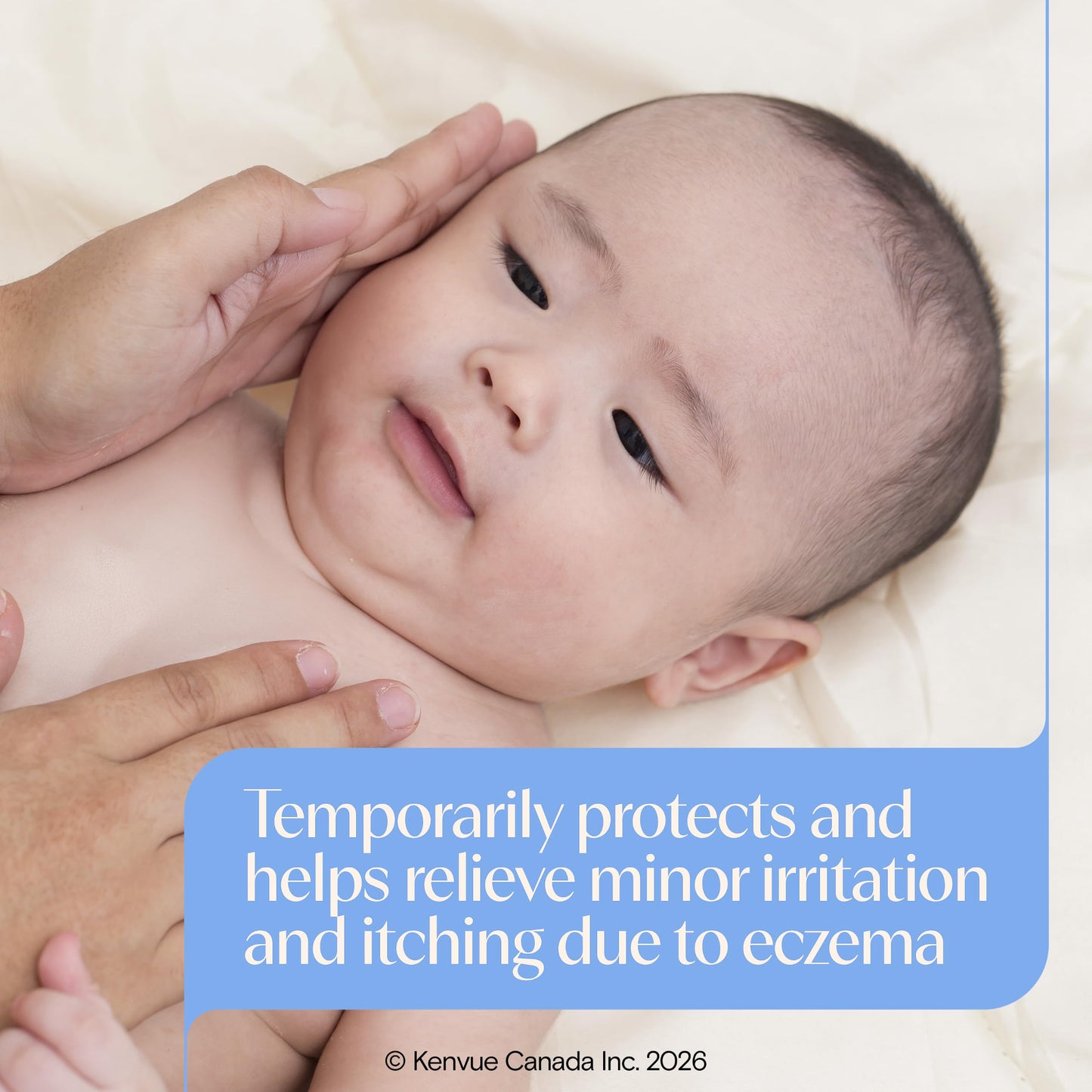 Aveeno Baby Eczema Care Daily Moisturizing Body Cream for Dry, Itchy Skin, Natural Colloidal Oat & Vitamin B5, Hypoallergenic & ph-Balanced, No Added Steroids, Phthalates, Parabens or Fragrance, 330mL