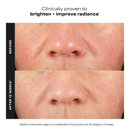 Paula's Choice C15 Super Booster, 15% Vitamin C with Vitamin E & Ferulic Acid, Brightening Serum for Discolouration, Dark Spots & Wrinkles, Fragrance-Free, 20 mL - Available at All In One Marketplace Canada