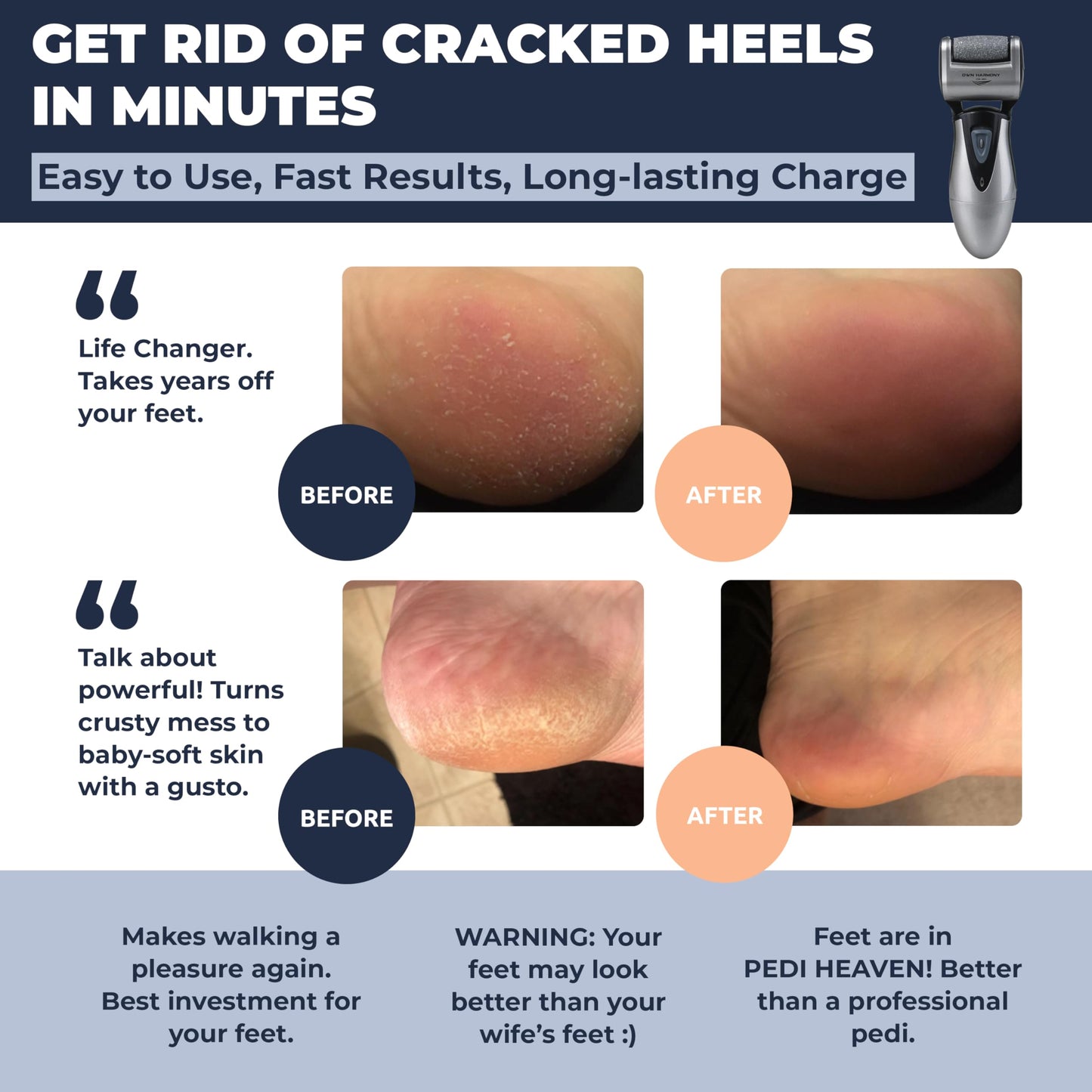 Callus Remover: Electric Rechargeable Pedicure Tools for Men/Women by Own Harmony w 3 Rollers (Tested Powerful) Best Foot File,Professional Spa Electronic Micro Pedi Feet Care Perfect for Cracked Skin