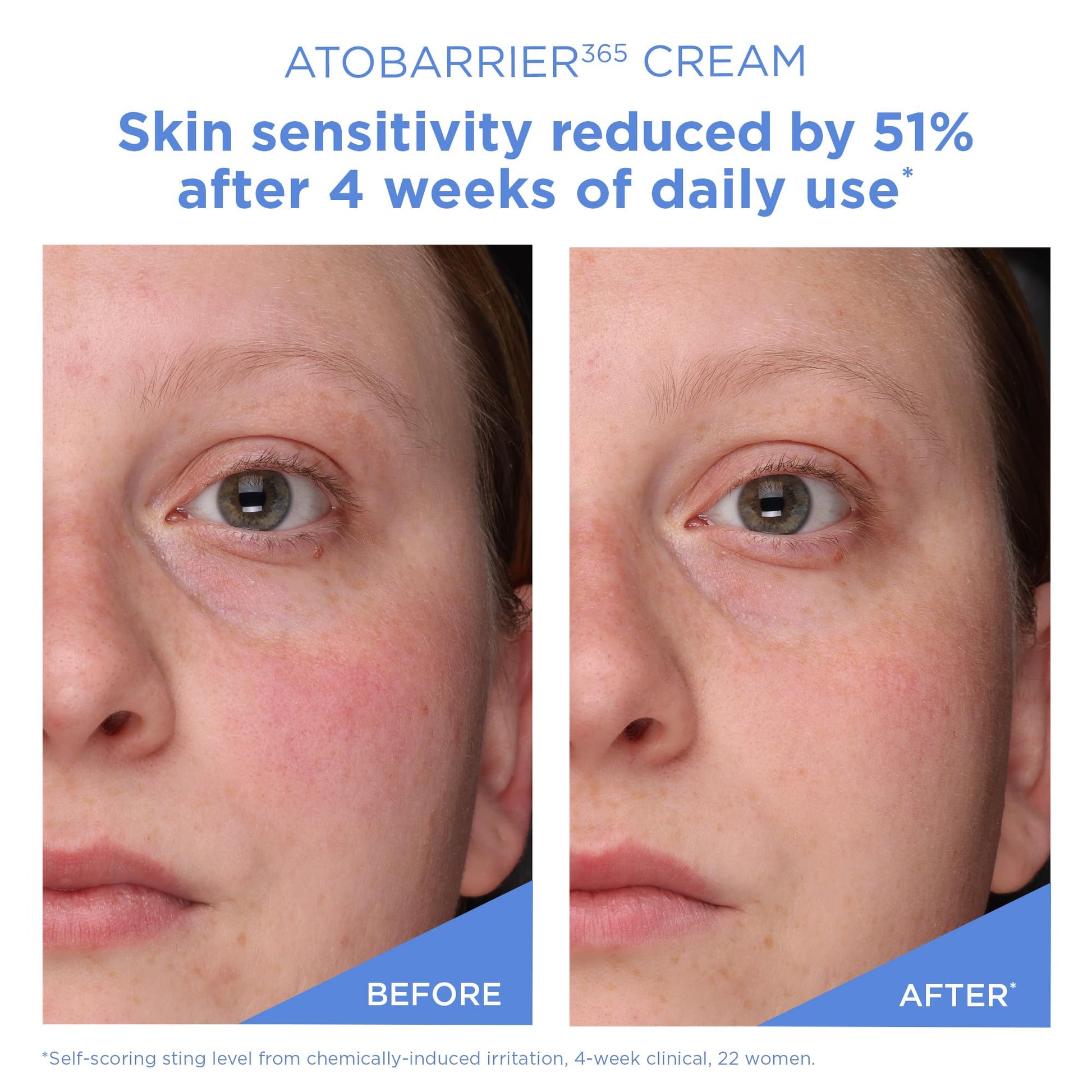 AESTURA ATOBARRIER365 Cream with Ceramides, Korean Face Moisturizer for Barrier Repair | 120H lasting Hydration, Ceramide Capsules, Dry & Sensitive Skin, Non-comedogenic, 80 mL / 2.70 fl.oz. - Available at All In One Marketplace Canada