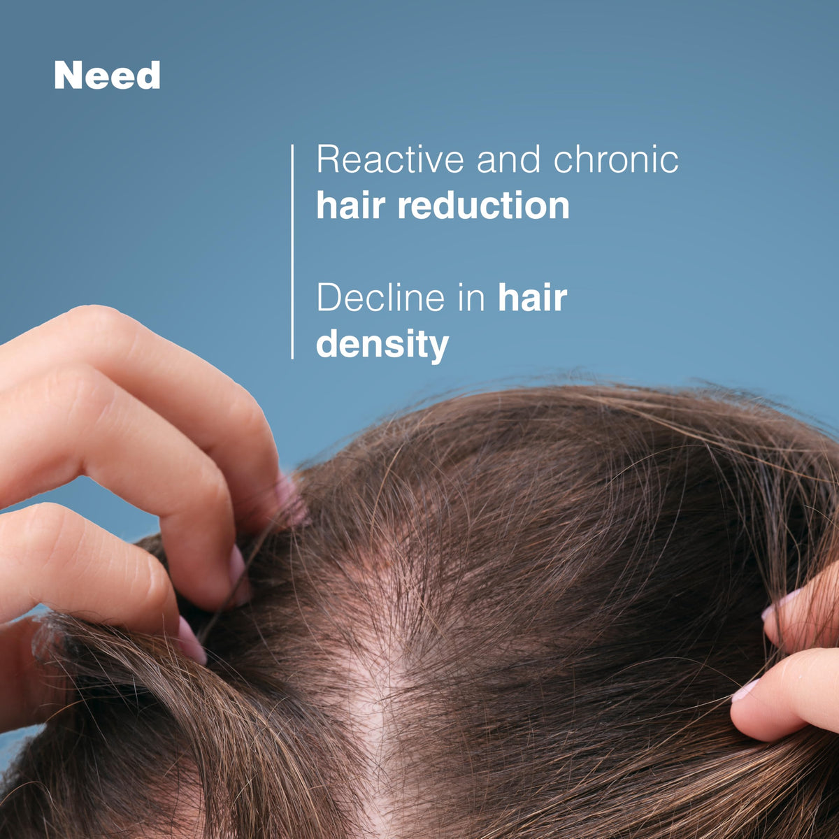 Ducray Anaphase Conditioner, Chronic & Reactional Hair Thinning, 200 ml