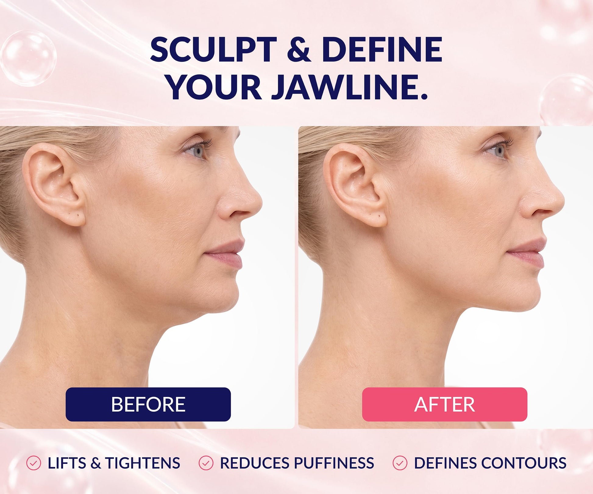 Stylia V Line Lifting Collagen Face Mask - Lift, Firm & Contour Jawline - Double Chin Strap with Hyaluronic Acid & Aloe Vera - Hydrating Neck & Face Tightening Mask - Chin Strap for Sleeping 10PC - Available at All In One Marketplace Canada