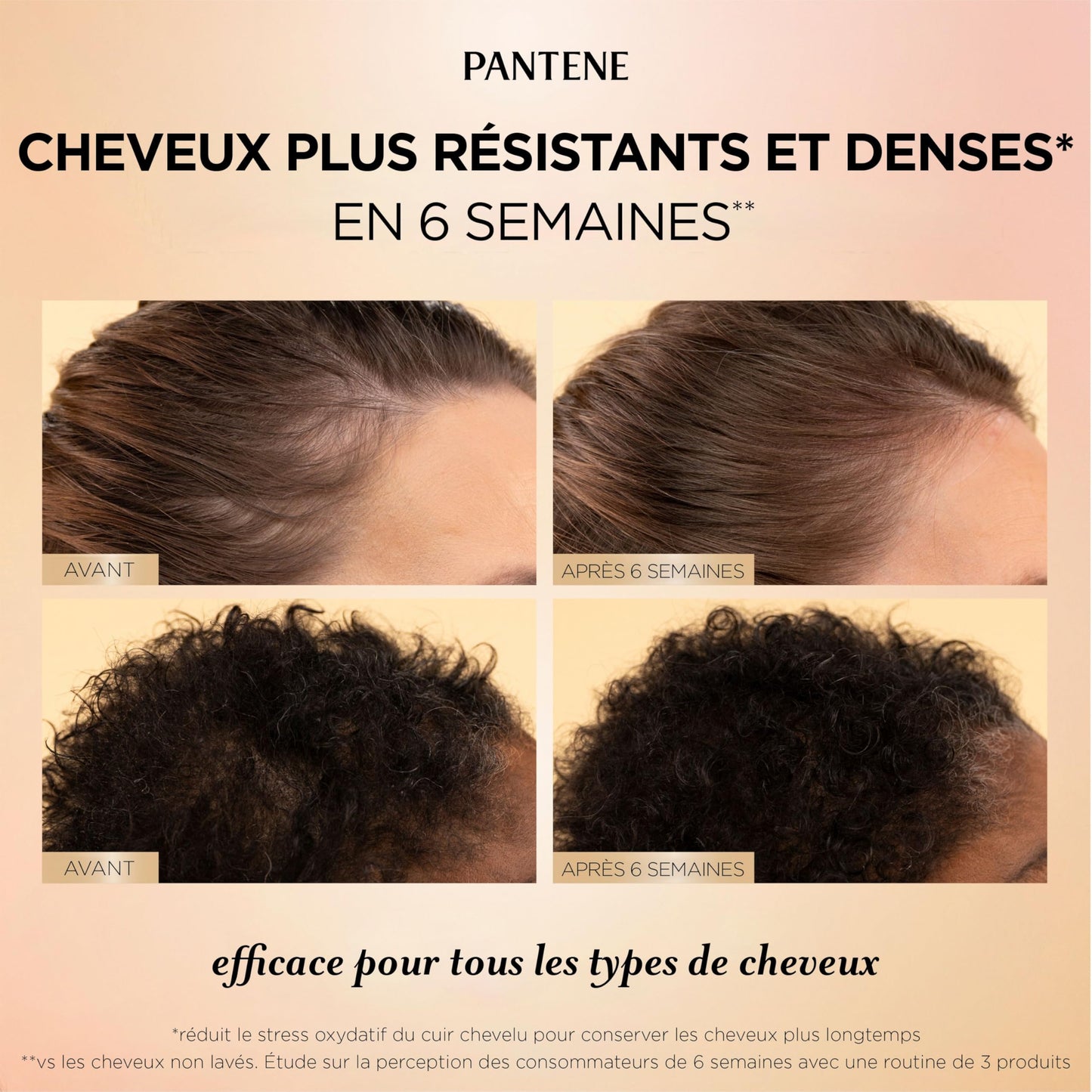 Pantene Abundant & Strong 3-Step System, Shampoo (400 ml), Conditioner (236 ml), Serum (60 ml), Strengthens at the Root, 3 Count - Available at All In One Marketplace Canada