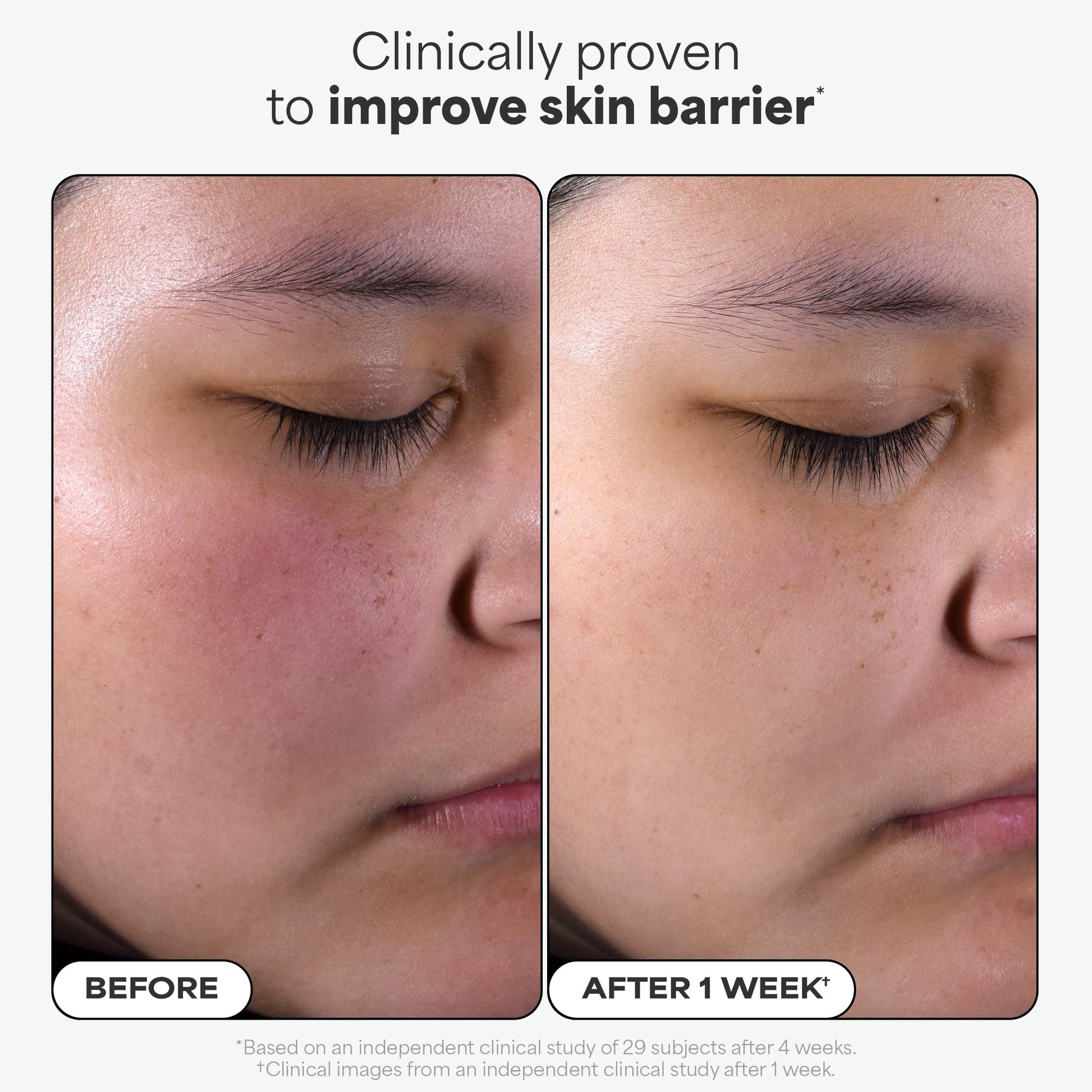 Paula's Choice SKIN PERFECTING 2% BHA Liquid Salicylic Acid Exfoliant Duo, Gentle Exfoliator for Enlarged Pores, Wrinkles & Fine Lines, Includes 1 Full Size Bottle & 1 Travel Size Bottle