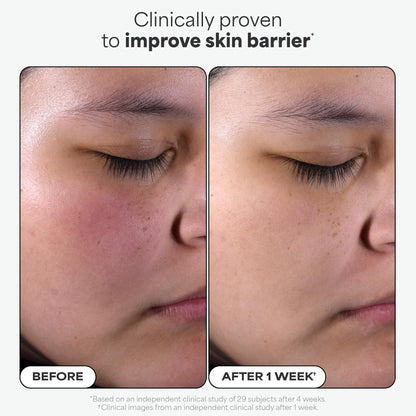 Paula's Choice SKIN PERFECTING 2% BHA Liquid Salicylic Acid Exfoliant Duo, Gentle Exfoliator for Enlarged Pores, Wrinkles & Fine Lines, Includes 1 Full Size Bottle & 1 Travel Size Bottle