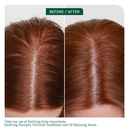 Biolage Scalp Sync Clarifying Shampoo for Oily Scalp BIOLAGE