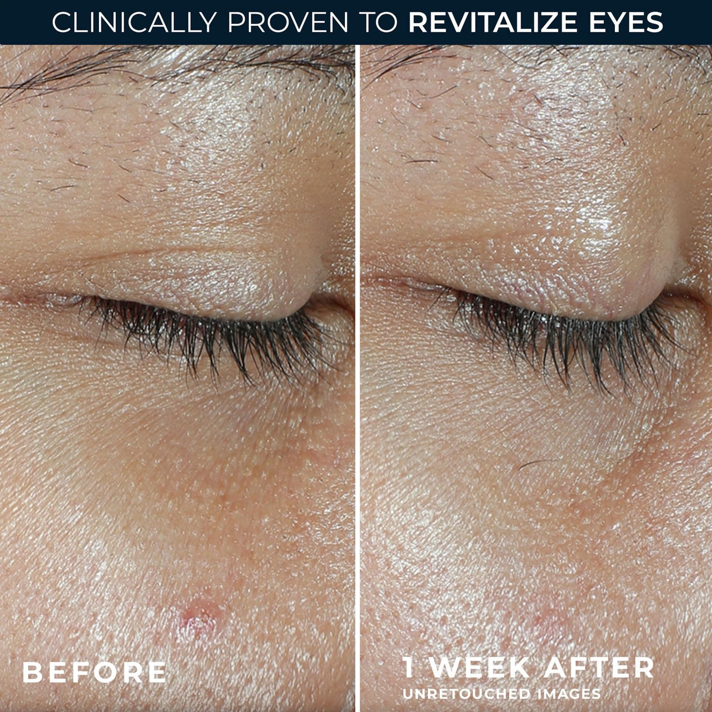 RoC Multi Correxion Revive + Glow Vitamin C with Peptides Eye Balm for Brighter Eyes 4G - Available at All In One Marketplace Canada