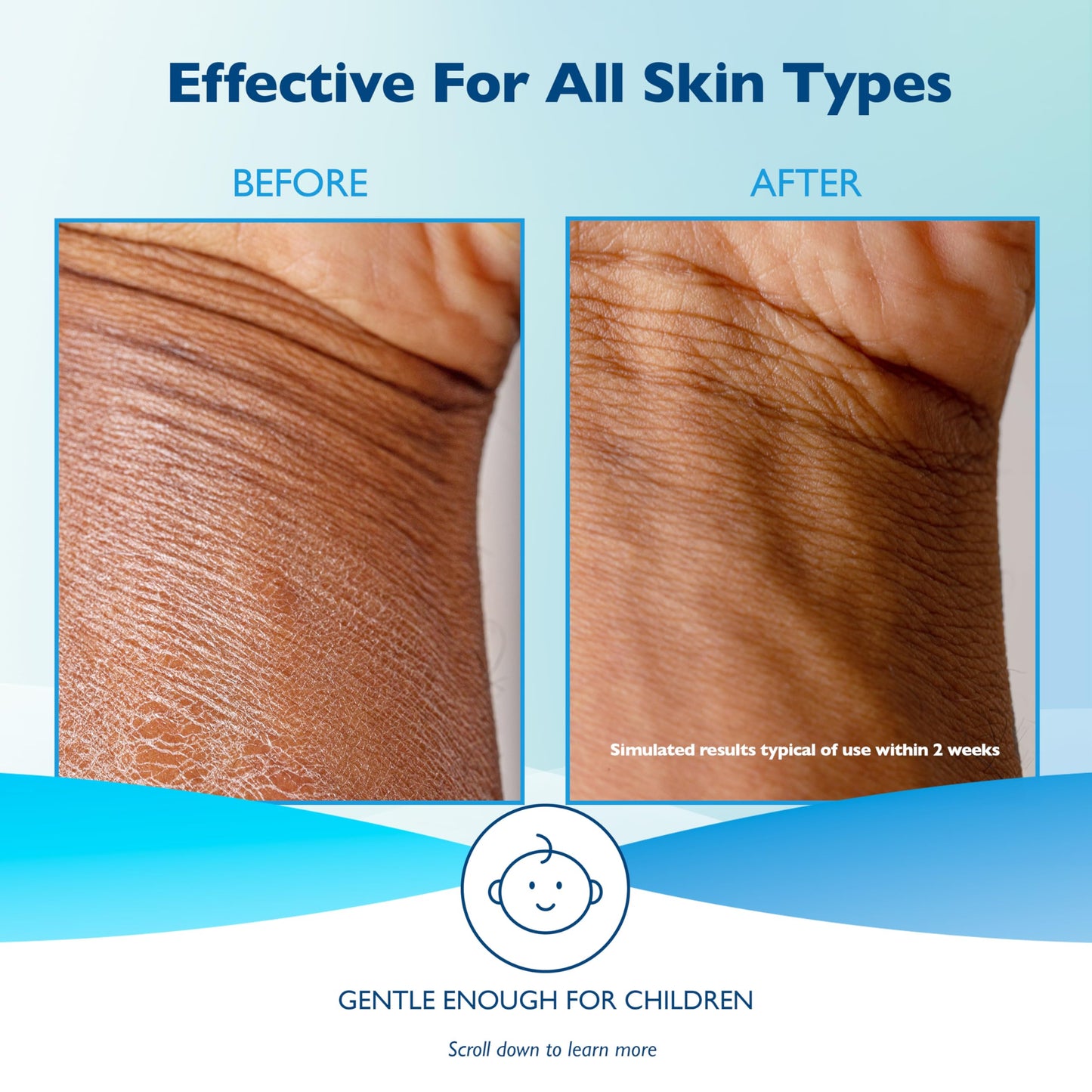 Glaxal Base Moisturizing Cream, Relief from Itchy, Dry Skin, Hypoallergenic & Paraben-Free, Made in Canada, 450 g Glaxal Base