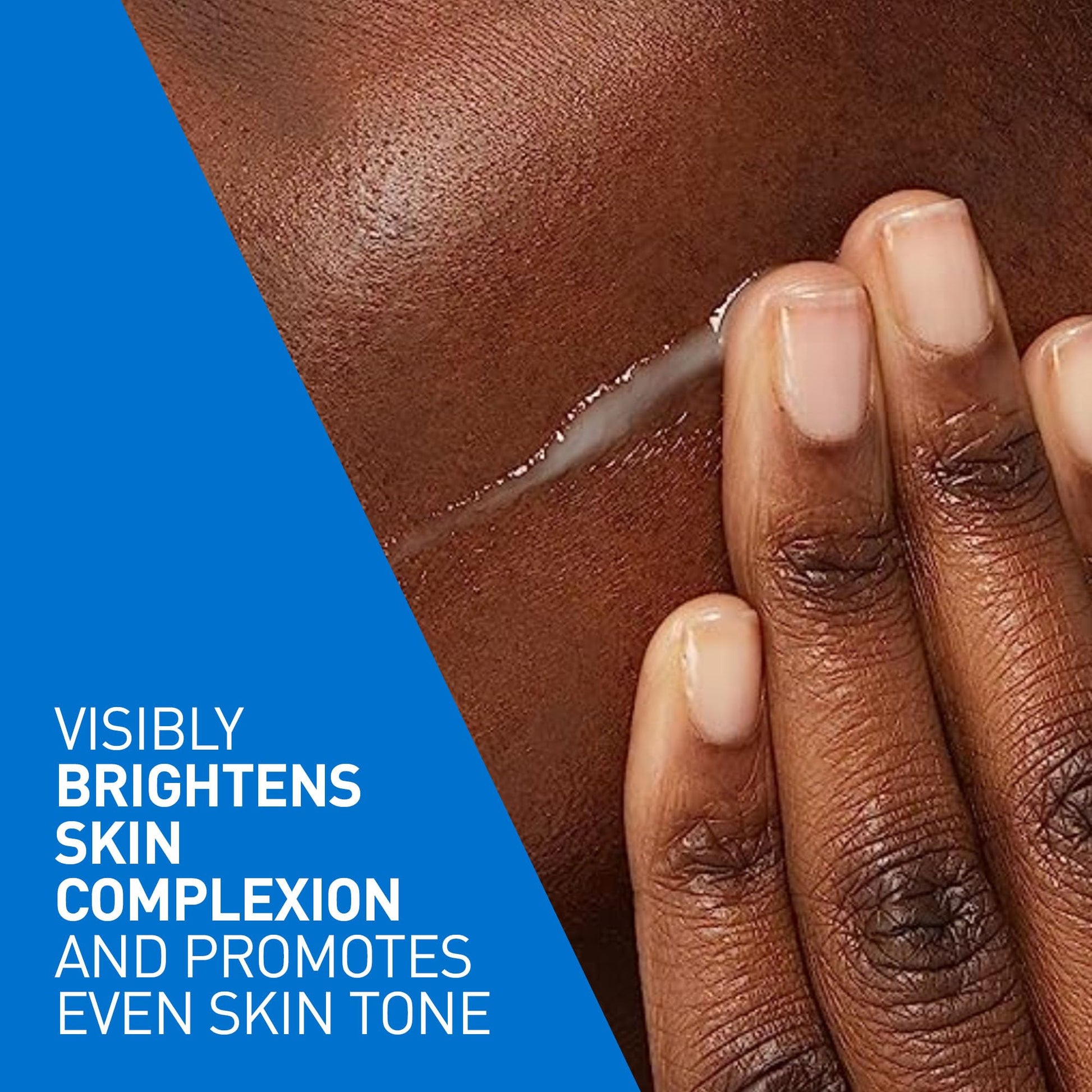 CeraVe Vitamin C Serum with Hyaluronic Acid, Ceramides & Vitamin B5, Skin Renewing 10% Pure Vitamin C Serum for Face, Reduces the Look of Dark Spots, Fragrance Free, Developed with Dermatologists, 30mL - Available at All In One Marketplace Canada