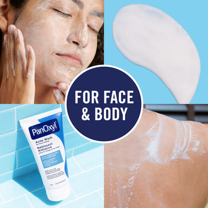 PanOxyl Acne Wash, 4% Benzoyl Peroxide, For Face & Body, 85g, Pack of 2 🍁 All In One Marketplace Canada