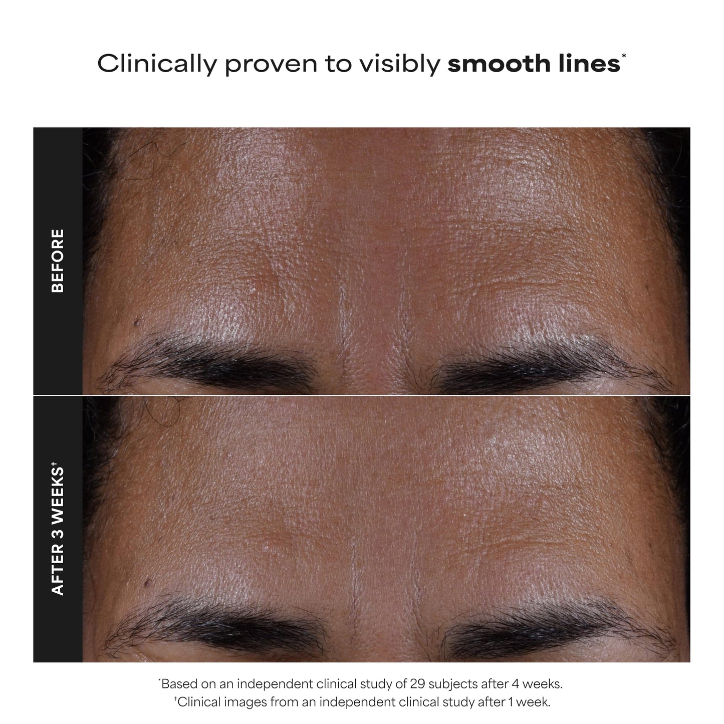 Paula's Choice SKIN PERFECTING 2% BHA Liquid Salicylic Acid Exfoliant, Daily Facial Exfoliator for Enlarged Pores, Wrinkles & Fine Lines, Fragrance-Free, Full Size - 118 ml