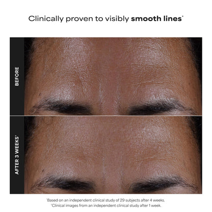 Paula's Choice SKIN PERFECTING 2% BHA Liquid Salicylic Acid Exfoliant, Daily Facial Exfoliator for Enlarged Pores, Wrinkles & Fine Lines, Fragrance-Free, Full Size - 118 ml