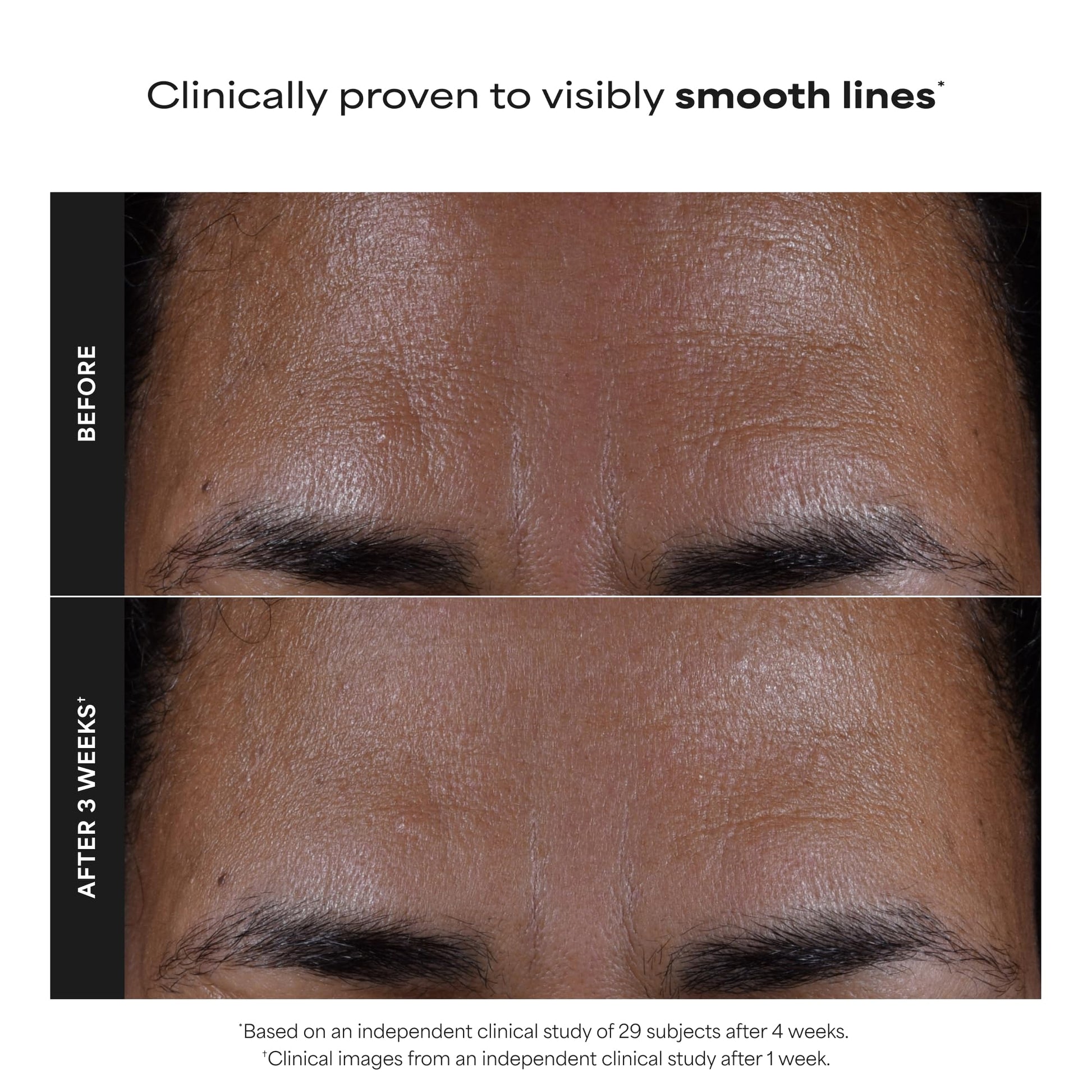 Paula's Choice SKIN PERFECTING 2% BHA Liquid Salicylic Acid Exfoliant, Daily Facial Exfoliator for Enlarged Pores, Wrinkles & Fine Lines, Fragrance-Free, Travel Size - 30 ml