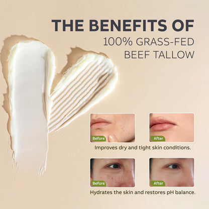 Beef Tallow and Honey Balm for Skin: Whipped Grass Fed Beef Tallow Balm Moisturizer with Raw Honey and Olive Oil for Face and Body - Natural Cow Fat Cream Unscented - Available at All In One Marketplace Canada