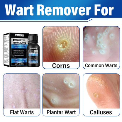 OSNOIA Extra Strength Wart Remover Liquid with 17% Salicylic Acid, Fast Acting Treatment for Plantar & Common Warts, Corn Remover for Feet and Toes (15ml, Wart Remover Set) - Available at All In One Marketplace Canada