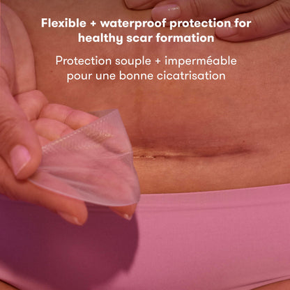 Frida Mom C-Section Silicone Strips, C-Section Recovery Must Have Scar Patches, Reusable Medical Grade Treatment for Keloid Scars, Includes Case & Pouch - Available at All In One Marketplace Canada
