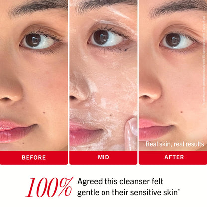 First Aid Beauty Ultra Gentle Cream-to-Foam Pure Facial Cleanser – Makeup Removing Face Cleanser - Face Wash with Colloidal Oatmeal & Glycerin, for Sensitive, Acne & Blemish-Prone Skin, 6 oz