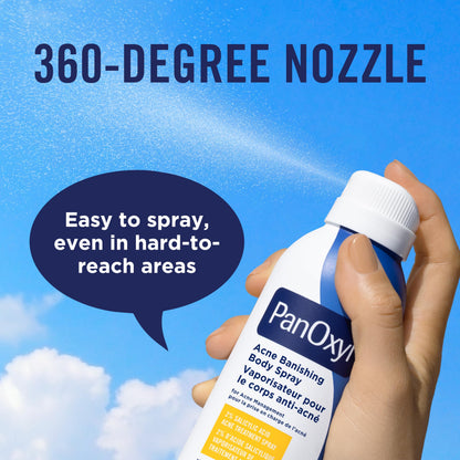 PanOxyl Acne Banishing Body Spray with 2% Salicylic Acid, Pimple Treatment to Help Clear Stubborn Breakouts, 360-Degree Spray Nozzle, Skin-Brightening Niacinamide, Vitamin C, Witch Hazel, Aloe, 170g