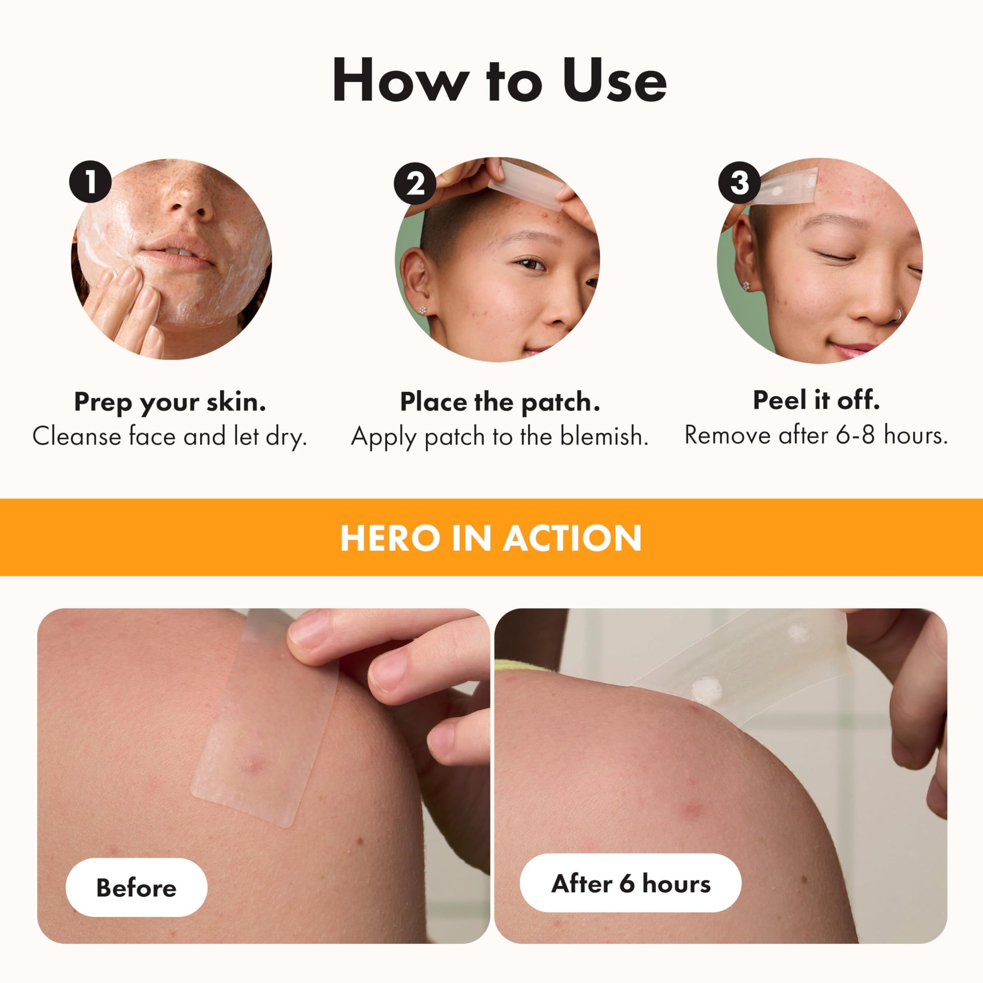 Hero Cosmetics Mighty Patch Surface – Large Hydrocolloid Patch for Pimples on the Body, Back and Face, Suitable for Sensitive Skin, 10 Count