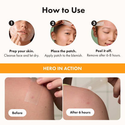 Hero Cosmetics Mighty Patch Surface – Large Hydrocolloid Patch for Pimples on the Body, Back and Face, Suitable for Sensitive Skin, 10 Count