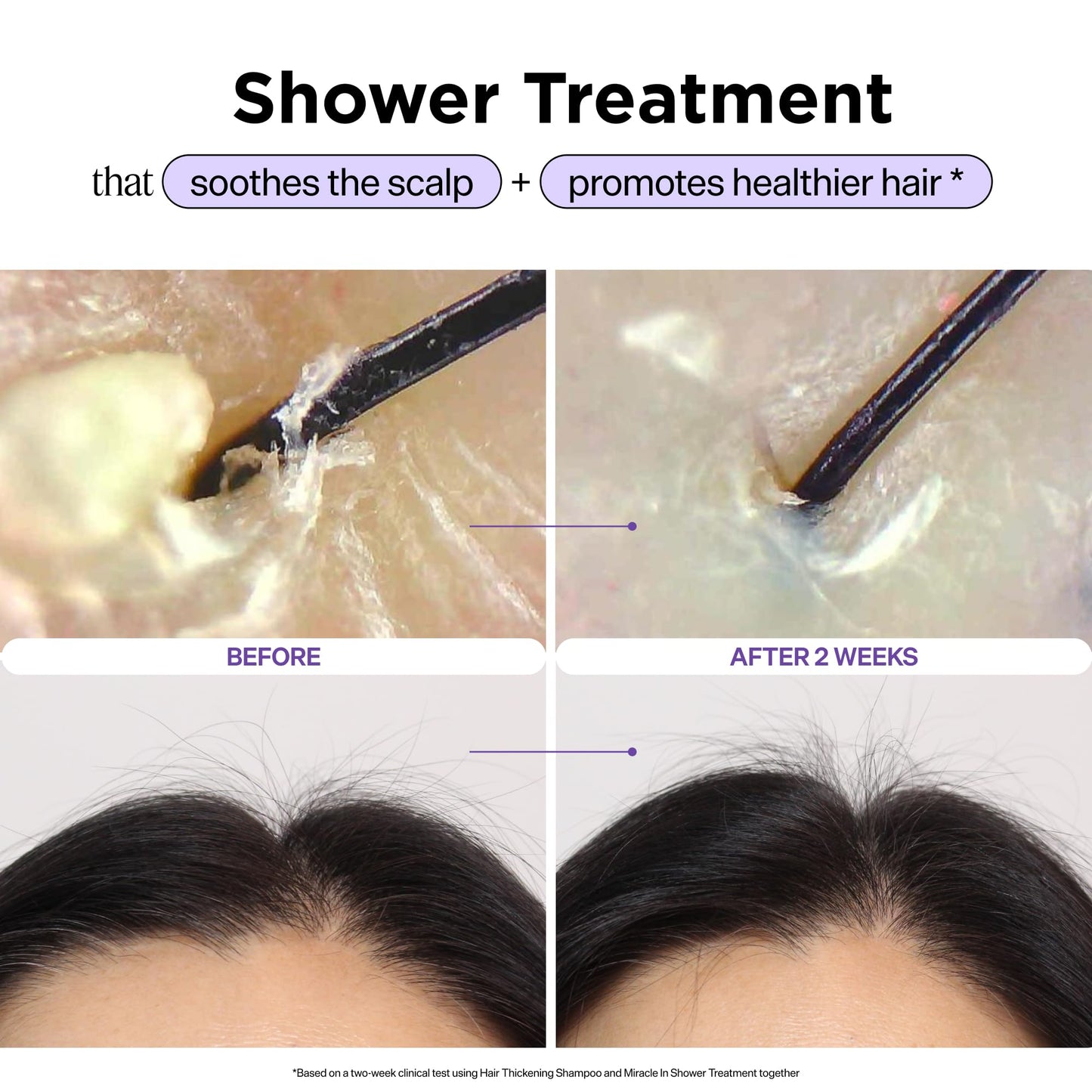 Dr. Groot Miracle in Shower Treatment, Korean Hair Care, 5 Seconds to Smooth Hair, Rosemary Oil for Healthier-Looking Hair, Hair Rinse, Moisturizing Treatment, Scalp Revitalizing Solution - Available at All In One Marketplace Canada