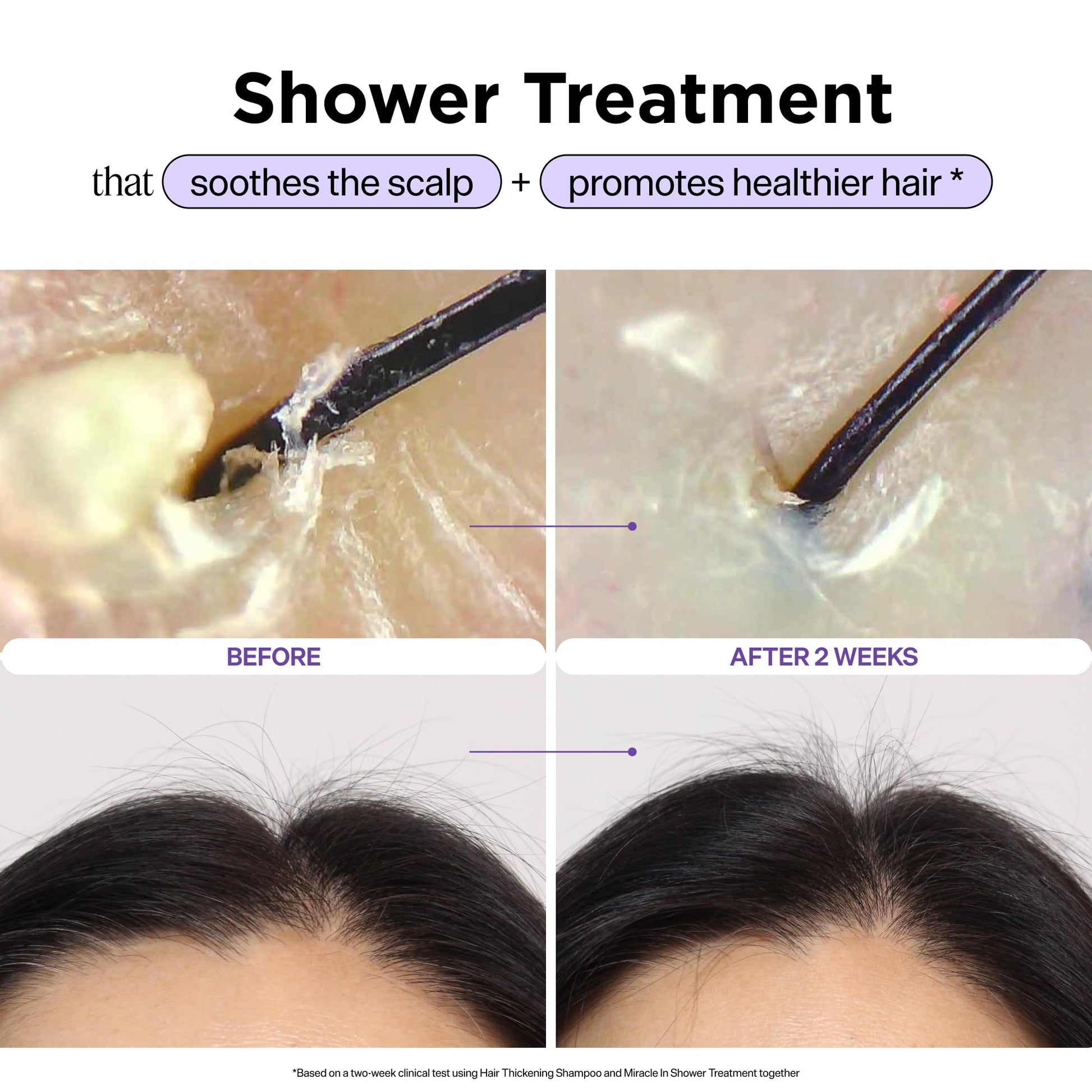 Dr. Groot Miracle in Shower Treatment, Korean Hair Care, 5 Seconds to Smooth Hair, Rosemary Oil for Healthier-Looking Hair, Hair Rinse, Moisturizing Treatment, Scalp Revitalizing Solution - Available at All In One Marketplace Canada