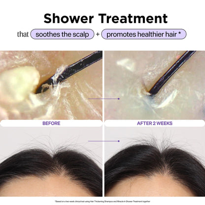 Dr. Groot Miracle in Shower Treatment, Korean Hair Care, 5 Seconds to Smooth Hair, Rosemary Oil for Healthier-Looking Hair, Hair Rinse, Moisturizing Treatment, Scalp Revitalizing Solution - Available at All In One Marketplace Canada