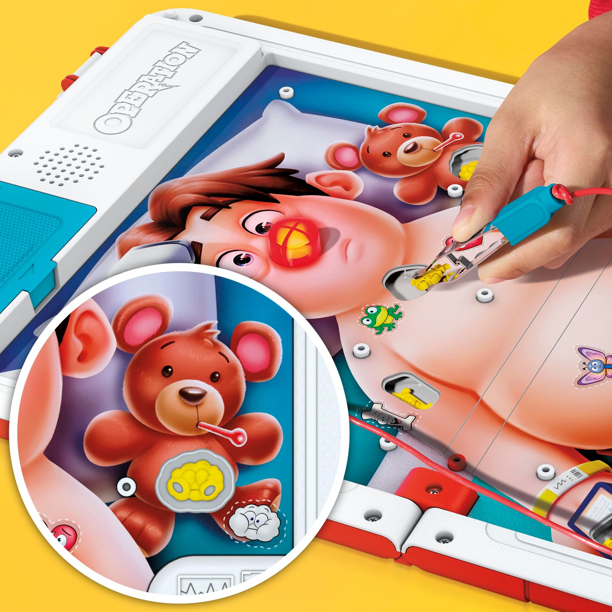 Operation Electronic Board Game with All-in-One Carrying Case | 2 Ways to Play | Ages 6+ | 1+ Players | 10 Mins. | Fun Kids Games (English & French) Hasbro Gaming