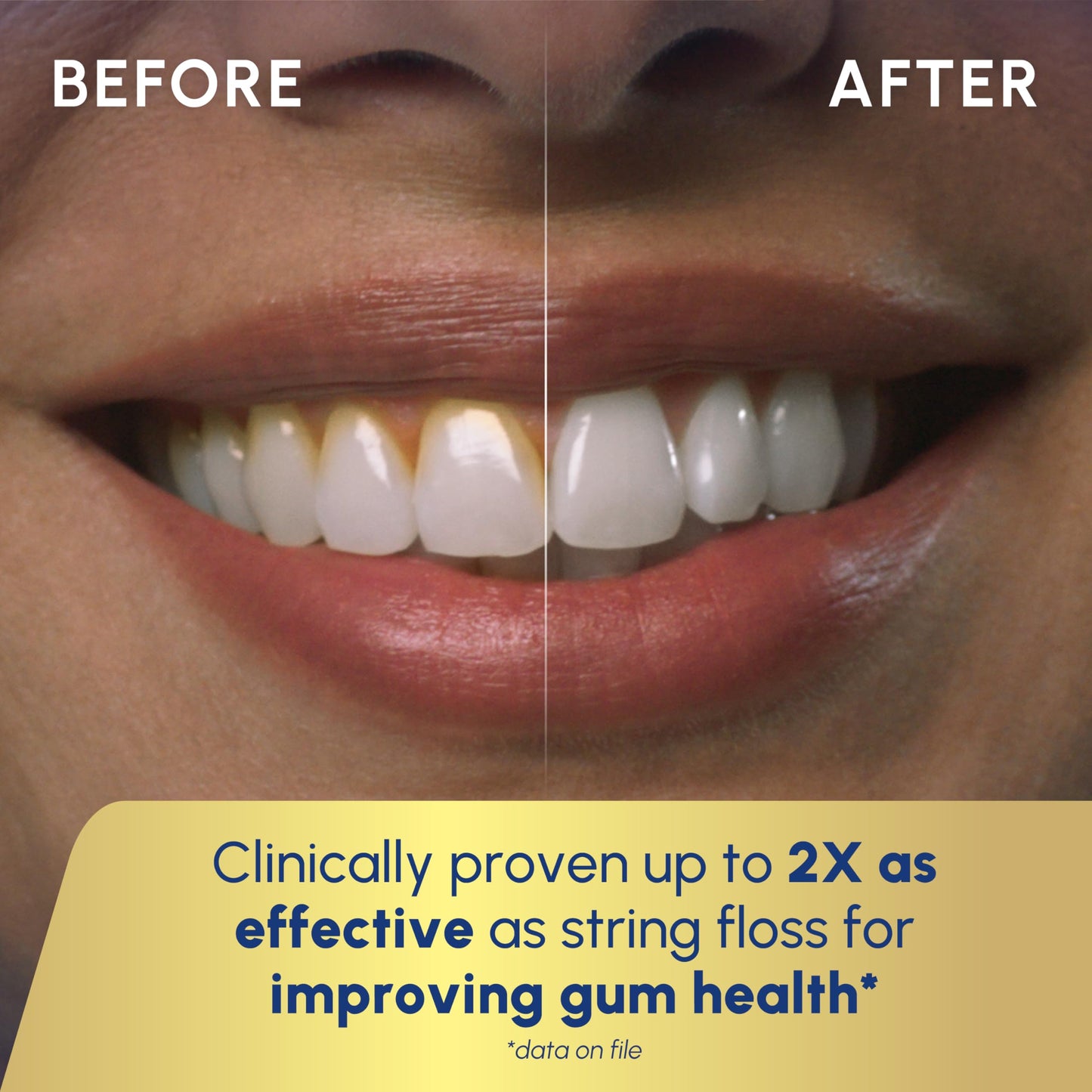 Waterpik Aquarius Water Flosser For Teeth Cleaning, Gums, Braces, Dental Care, Electric Power With 10 Settings, 7 Tips For Multiple Users & Needs, CDA Validated, Blue WP-663, Packaging May Vary Waterpik