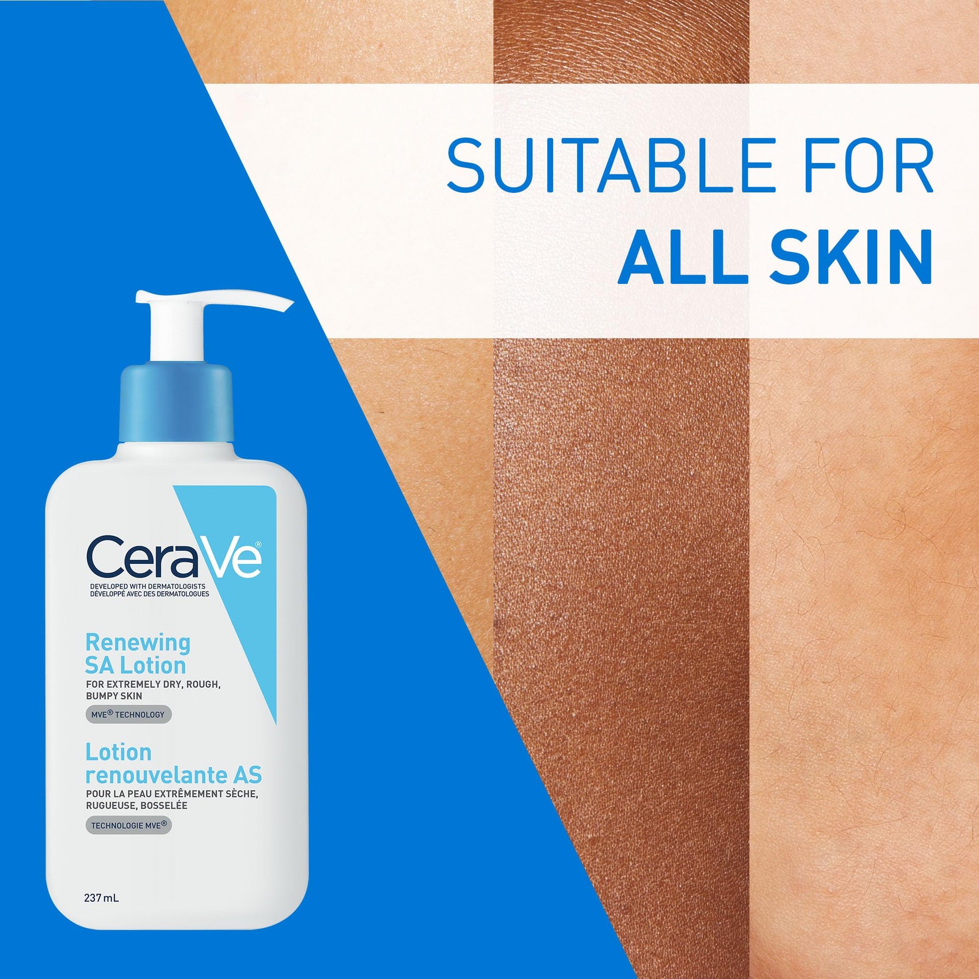 CeraVe SALICYLIC ACID Lotion, Renewing SA Exfoliating Body Lotion for Dry, Rough & Bumpy Skin, Psoriasis, Keratosis Pilaris, Itching & Flaking. With Lactic Acid, Hyaluronic Acid, Fragrance Free, 237ML