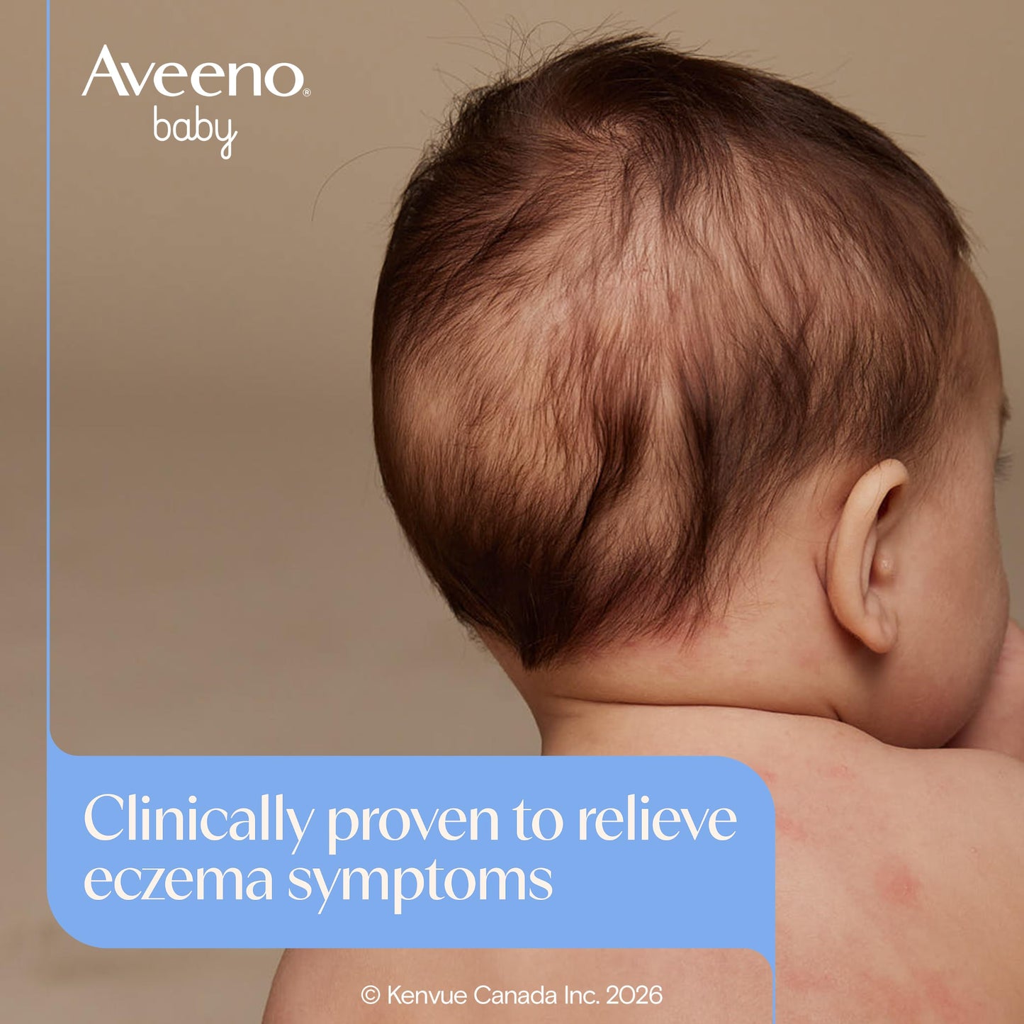 Aveeno Baby Eczema Care Daily Moisturizing Body Cream for Dry, Itchy Skin, Natural Colloidal Oat & Vitamin B5, Hypoallergenic & ph-Balanced, No Added Steroids, Phthalates, Parabens or Fragrance, 330mL