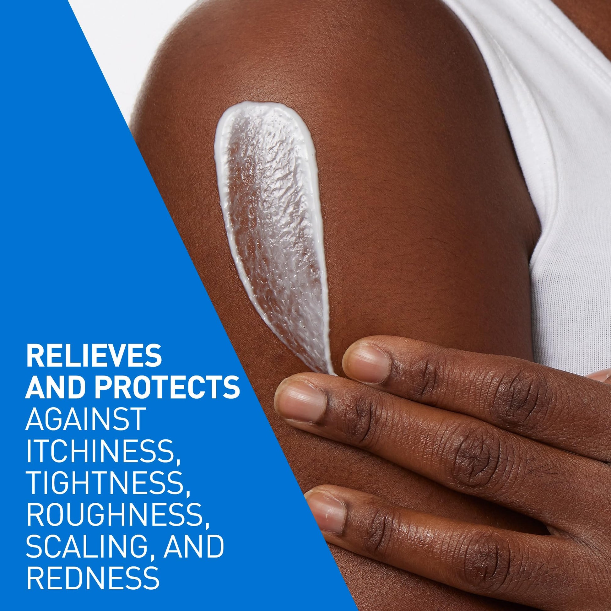 CeraVe Intensive Moisturizing Lotion with 5% Hydro-Urea & Shea Butter, for Dry to Very Dry Skin, Hydrates Itchy Skin due to Dryness. Fragrance-Free, Developed with Dermatologist, 473mL - Available at All In One Marketplace Canada