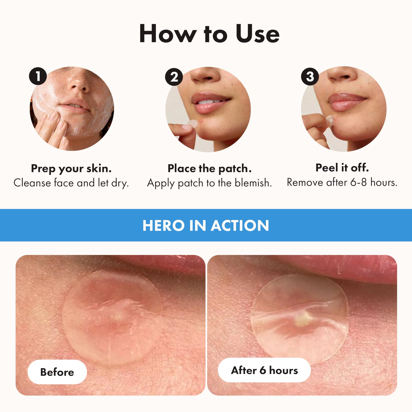 Hero Cosmetics Mighty Patch Invisible+ – Barely-there Hydrocolloid Patch for Pimples on the Face, Day-time Patches for Sensitive Skin, 39 Count