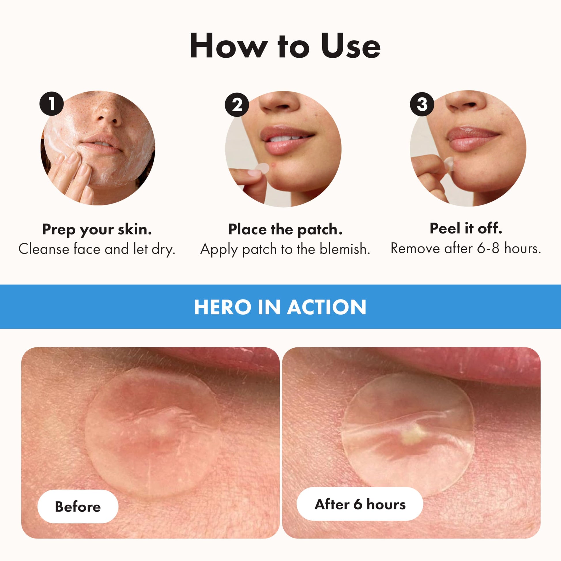 Hero Cosmetics Mighty Patch Invisible+ – Barely-there Hydrocolloid Patch for Pimples on the Face, Day-time Patches for Sensitive Skin, 39 Count
