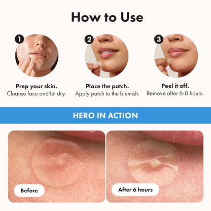 Hero Cosmetics Mighty Patch Invisible+ – Barely-there Hydrocolloid Patch for Pimples on the Face, Day-time Patches for Sensitive Skin, 39 Count