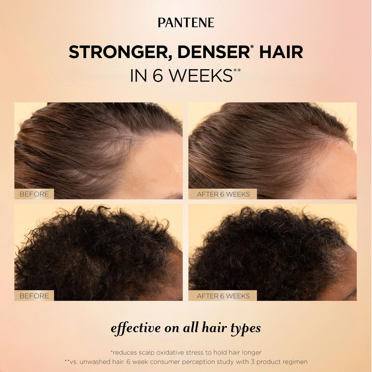 Pantene Abundant & Strong 3-Step System, Shampoo (400 ml), Conditioner (236 ml), Serum (60 ml), Strengthens at the Root, 3 Count - Available at All In One Marketplace Canada
