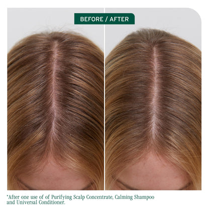 Biolage Scalp Sync Universal Conditioner for All Scalp Types