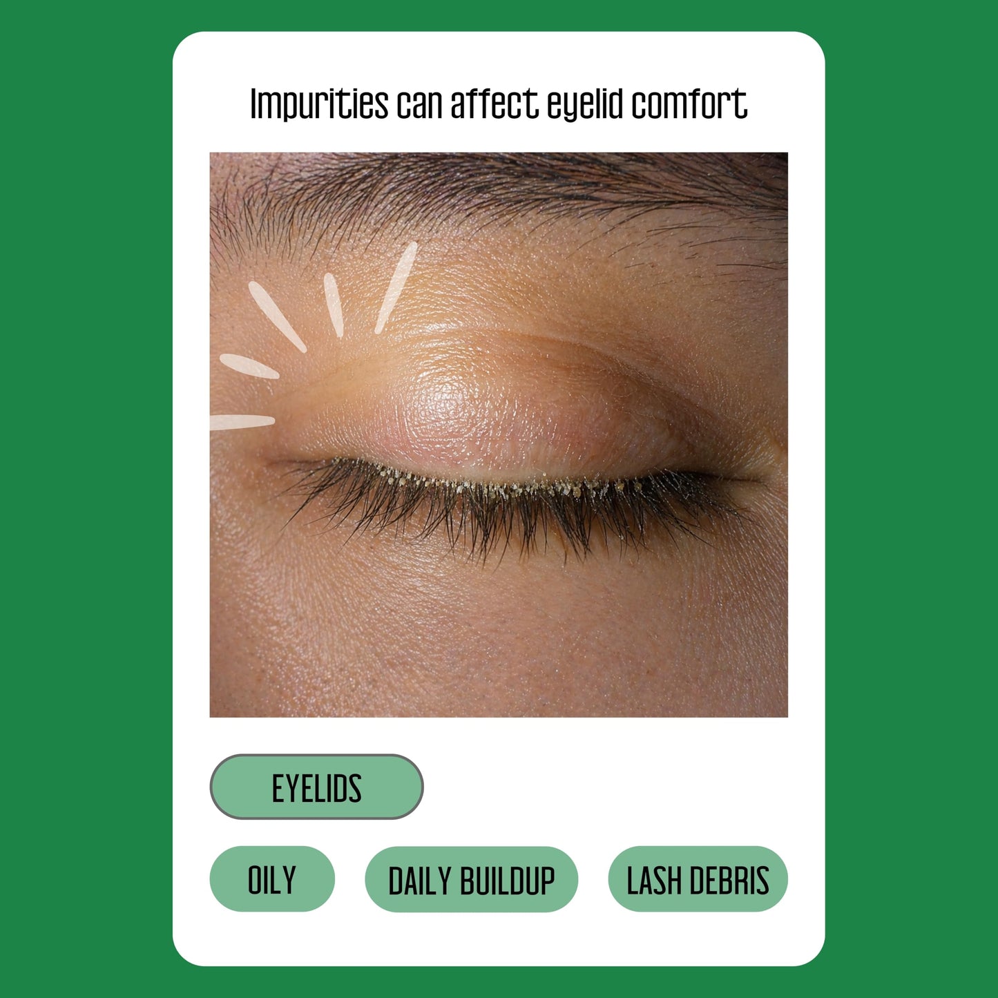 Tea Tree Eyelid Wipes – 100 Tea Tree Oil Eye Wipes for People with Dry Eyes & Allergies – Gentle Eyelid Cleanser with Hyaluronic Acid – Individually Wrapped & Biodegradable - Available at All In One Marketplace Canada