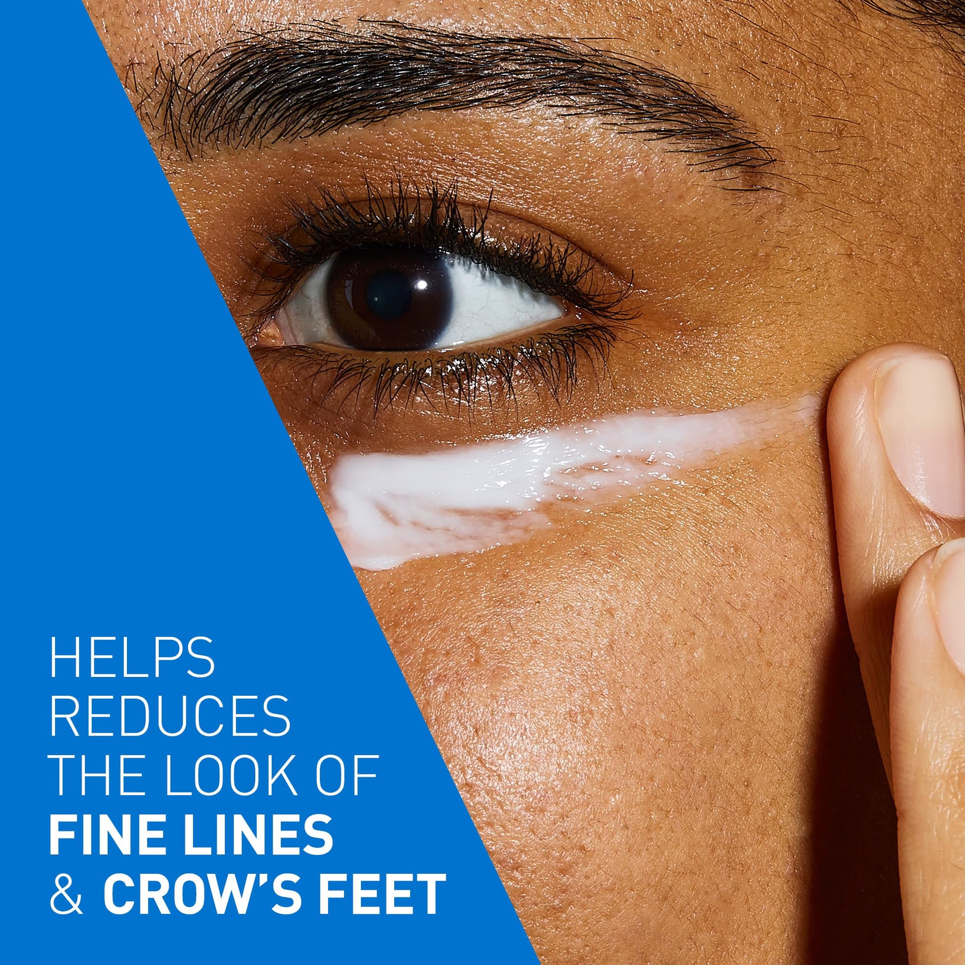 CeraVe Skin Renewing Eye Cream, Under Eye Cream with Caffeine, Peptides, & Hyaluronic Acid, Reduce Appearance of Fine Lines. Fragrance-Free & Ophthalmologist Tested, 15 mL - Available at All In One Marketplace Canada