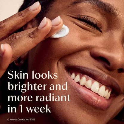 Aveeno Positively Radiant Daily Moisturizer SPF 15 - Face Lotion with Soy Formula for Dry Skin, Hypoallergenic & Oil-Free Lotion, Evens Tone & Texture, Non-Comedogenic Moisturizer for Face 120 mL