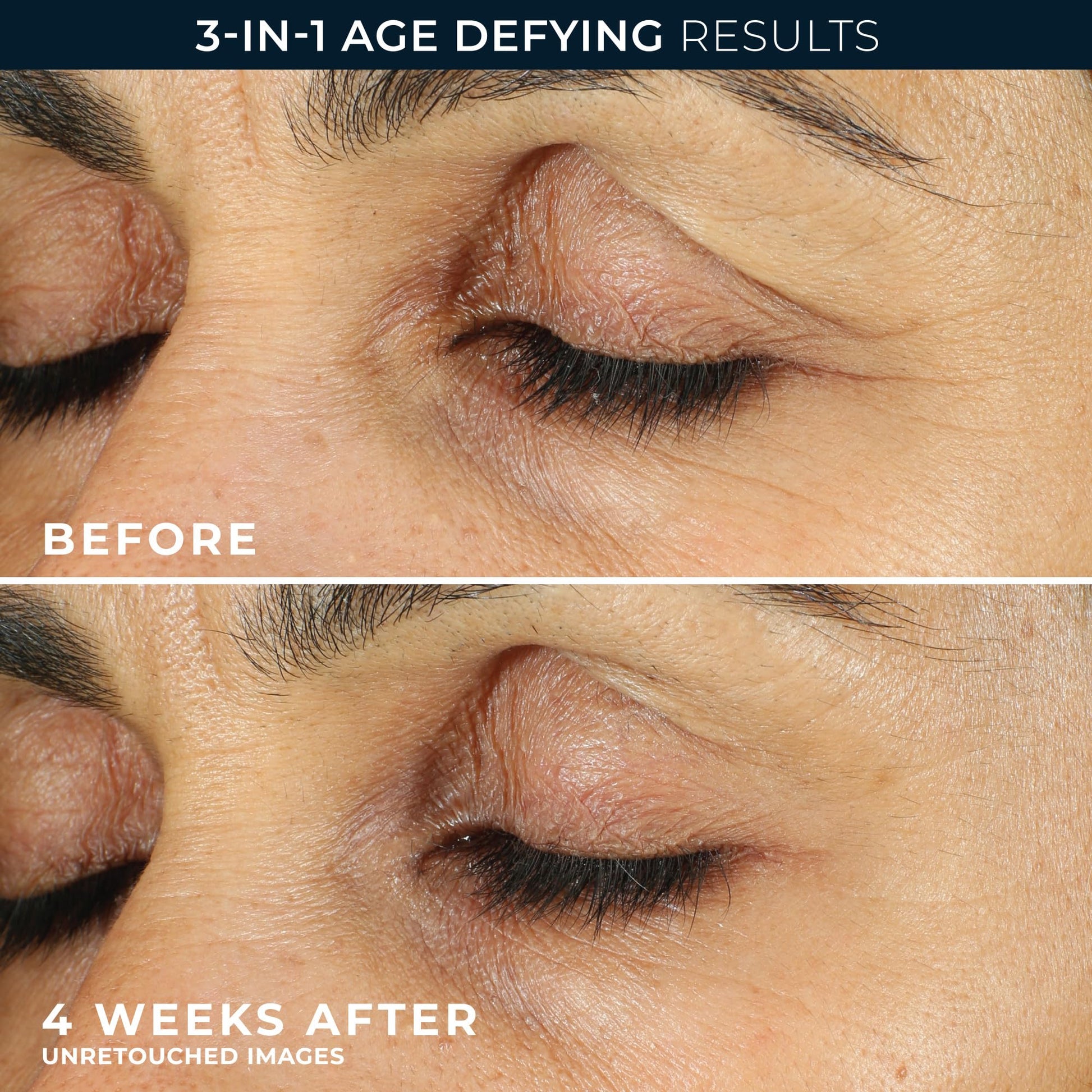 RoC Retinol Correxion Under Eye Cream for Dark Circles & Puffiness, Daily Wrinkle Cream, Anti Aging Line Smoothing Skin Care Treatment for Women and Men, with Retinol Eye Cream Packette - Available at All In One Marketplace Canada