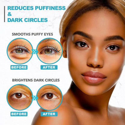 Under Eye Patches For Puffy Eyes And Dark Circles - Retinol Collagen Under Eye Masks - Reduce Wrinkles & Bags - Skin Treatment Pads - Anti Aging Moisturizer Mask For Women Gift - 60 Gel Pads - Available at All In One Marketplace Canada