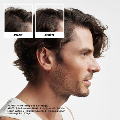 Nioxin Scalp + Hair Thickening System 2 Shampoo, For Natural Hair with Progressed Thinning, 10.1 fl oz (Packaging May Vary) 🍁 All In One Marketplace Canada
