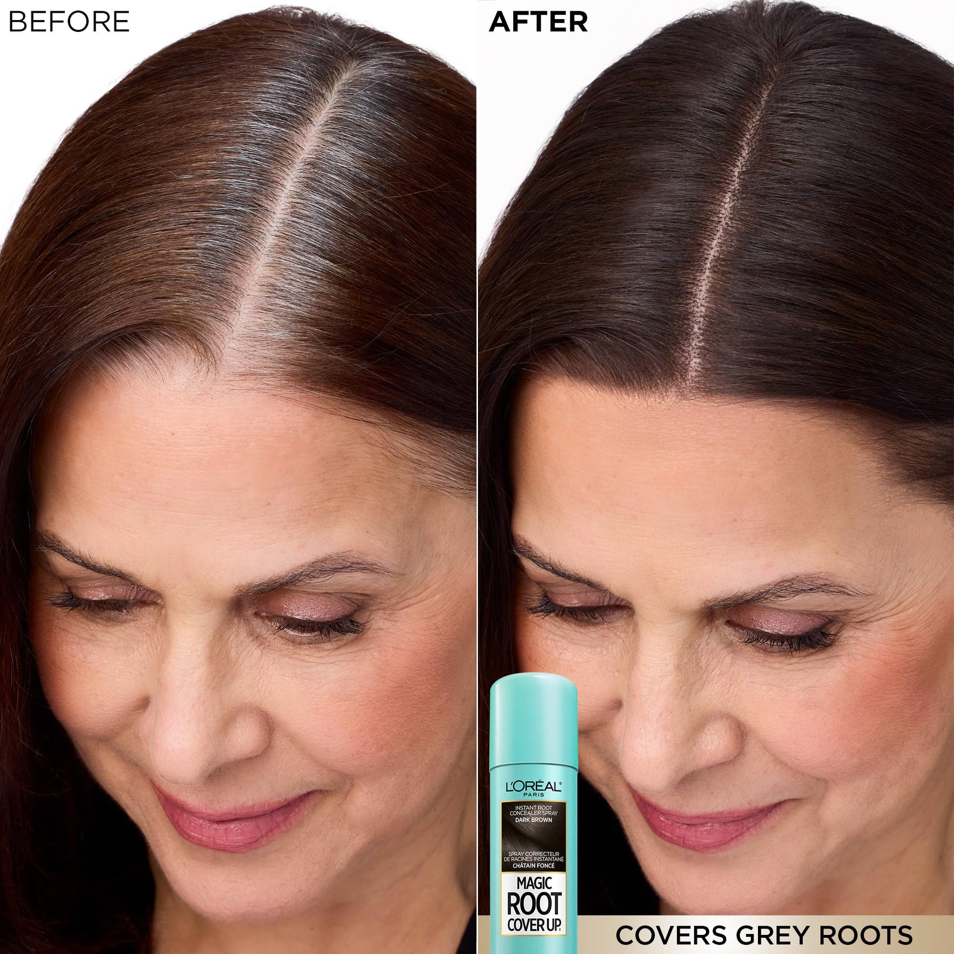 L'Oréal Paris Magic Root Cover Up Root Touch Up, Medium Brown Blonde Hair Dye, Root Touch Up Spray for Thinning Hair, Temporary Hair Dye, Grey Coverage, Pack of 2 L'Oreal Paris