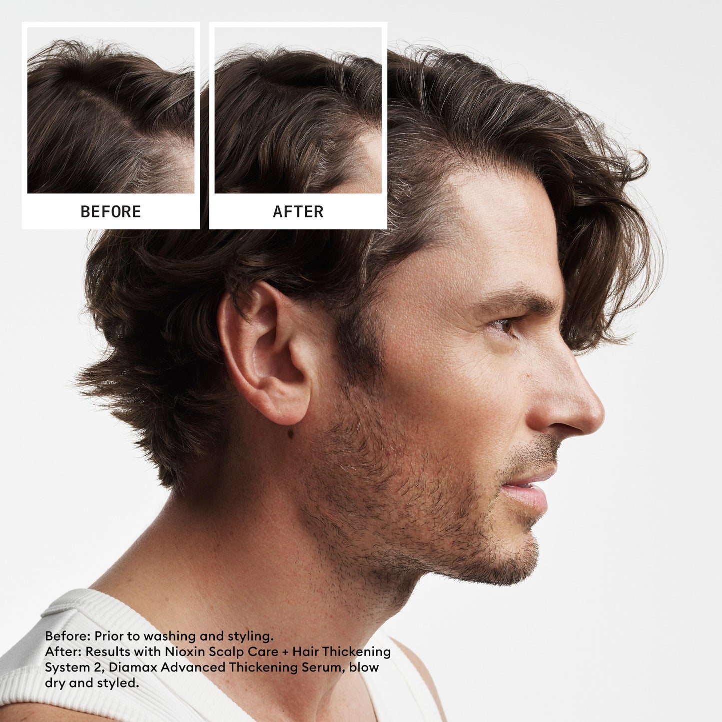 Nioxin Scalp + Hair Thickening System 2 - Hair Thickening System for Natural Hair with Progressed Thinning, Trial Size (Packaging May Vary) - Available at All In One Marketplace Canada