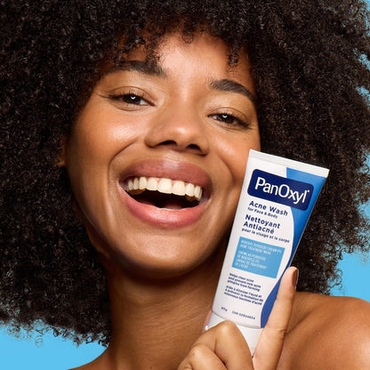 PanOxyl Acne Wash, 4% Benzoyl Peroxide, For Face & Body, 85g, Pack of 2 🍁 All In One Marketplace Canada