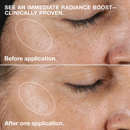 Clinique 3-Step Clarifying Lotion Face Exfoliator For Dry Combination Skin Types, Dry Combination Skin, 200ml Clinique