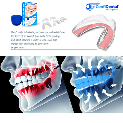 The ConfiDental - Moldable Mouth Guard for Teeth Grinding Clenching Bruxism Sport Athletic Whitening Tray Pack of 5 Including 3 Regular and 2 Heavy Duty Guard (3 (Ill) Regular 2 (ll) Heavy Duty)