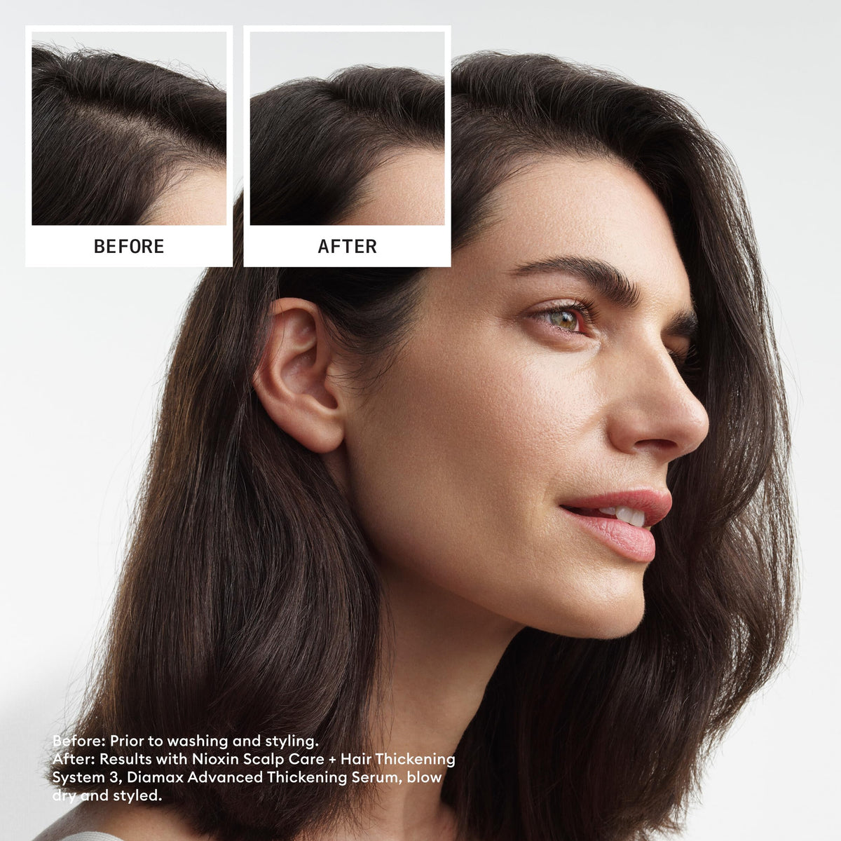 Nioxin System 3 | Scalp & Hair Shampoo | Coloured, Dry, & Damaged Hair