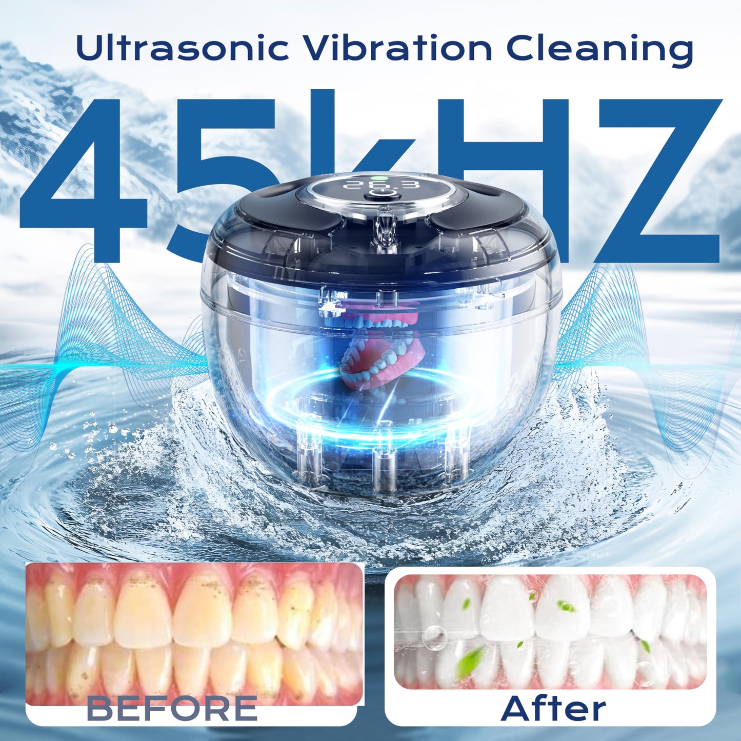 Ultrasonic Retainer Cleaner(2026 Upgraded), 45kHz Cleaning Machine for Dentures, Mouth Guards, Braces, Toothbrush & Jewelry, 200ML Denture Cleaner with 4 Modes for Denture Appliances - Available at All In One Marketplace Canada